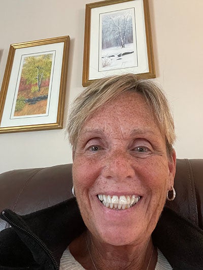 Older blond woman with very freckled and sunburnt face smiling a toothy smile. 